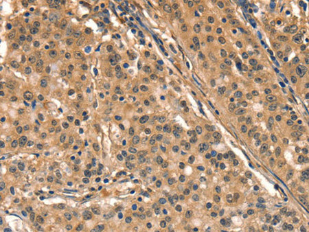 AIMP1 Polyclonal Antibody Store at -20°C