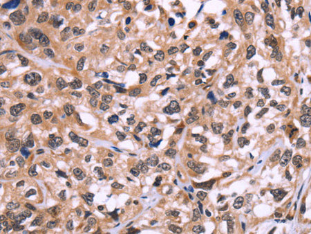 AMIGO2 Polyclonal Antibody Store at -20°C