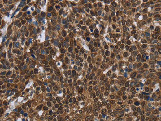 FASTKD2 Polyclonal Antibody Store at -20°C