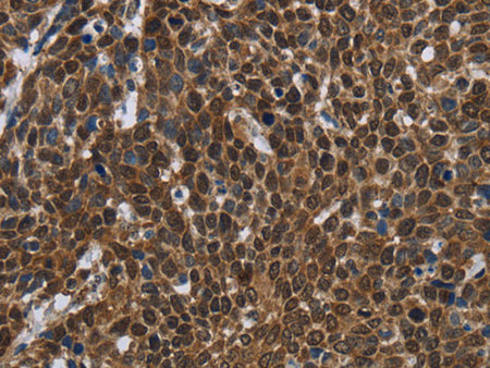 FASTKD2 Polyclonal Antibody Store at -20°C