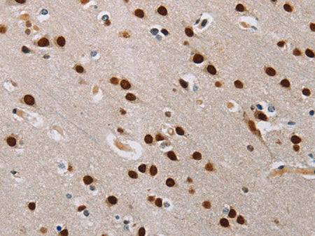 TONSL Polyclonal Antibody Store at -20°C
