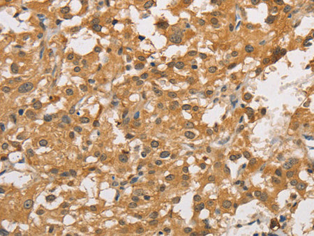 ARHGEF5 Polyclonal Antibody Store at -20°C