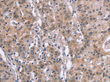 GPR172B Polyclonal Antibody Store at -20°C