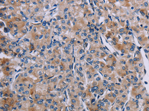 KDM4D Polyclonal Antibody Store at -20°C