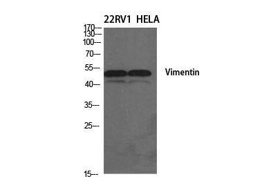 Vimentin Polyclonal Antibody Store at -20°C