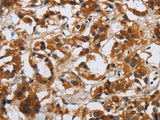 DSP Polyclonal Antibody Store at -20°C