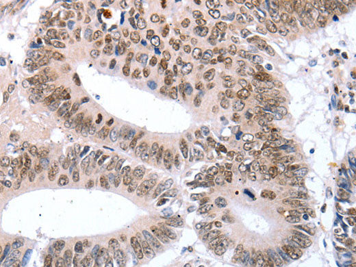 TBX2 Polyclonal Antibody Store at -20°C