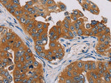 MBNL3 Polyclonal Antibody