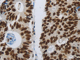 SLC16A14 Polyclonal Antibody