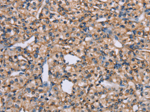 ADAM29 Polyclonal Antibody