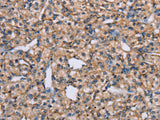 ADAM29 Polyclonal Antibody