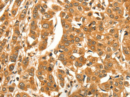 DIRAS1 Polyclonal Antibody Store at -20°C