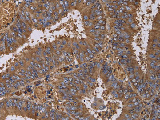 FADS1 Polyclonal Antibody Store at -20°C