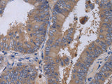 MKKS Polyclonal Antibody Store at -20°C
