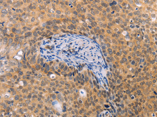 pVHL Polyclonal Antibody