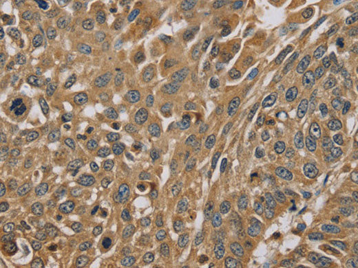 MYL3 Polyclonal Antibody Store at -20°C