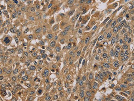 MYL3 Polyclonal Antibody Store at -20°C