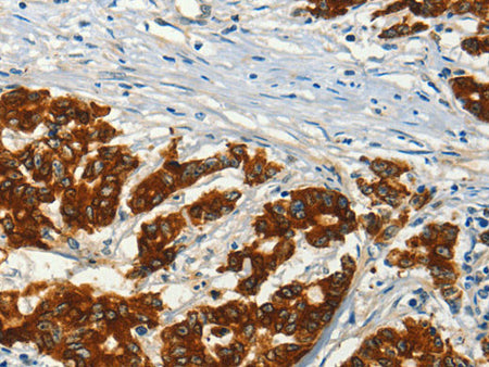 ADCY3 Polyclonal Antibody Store at -20°C