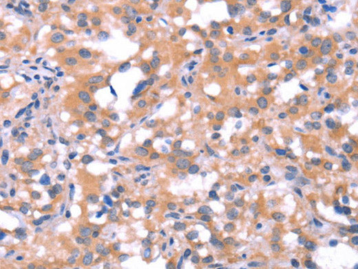 FAT1 Polyclonal Antibody Store at -20°C