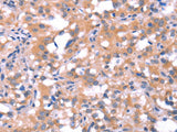 FAT1 Polyclonal Antibody Store at -20°C