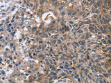 RASSF7 Polyclonal Antibody