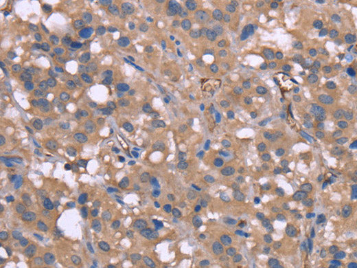 HP Polyclonal Antibody Store at -20°C