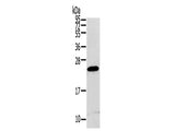 RGS1 Polyclonal Antibody Store at -20°C