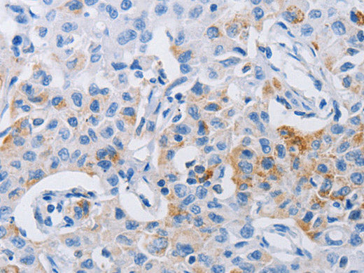 LRIG1 Polyclonal Antibody Store at -20°C