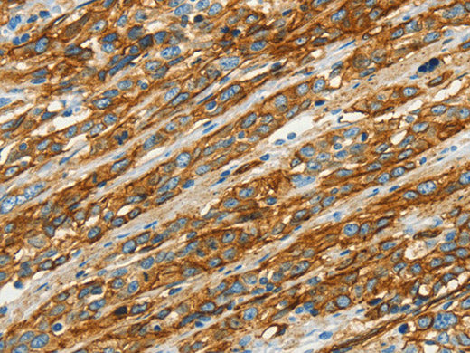 CAV1 Polyclonal Antibody Store at -20°C