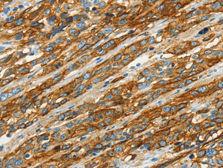 CAV1 Polyclonal Antibody Store at -20°C