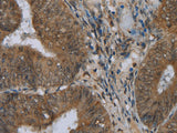 NAT10 Polyclonal Antibody