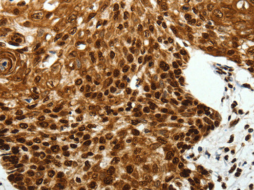 SCN1A Polyclonal Antibody Store at -20°C