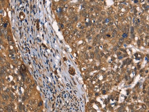 CSTB Polyclonal Antibody Store at -20°C