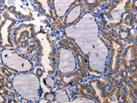 DRD1 Polyclonal Antibody Store at -20°C