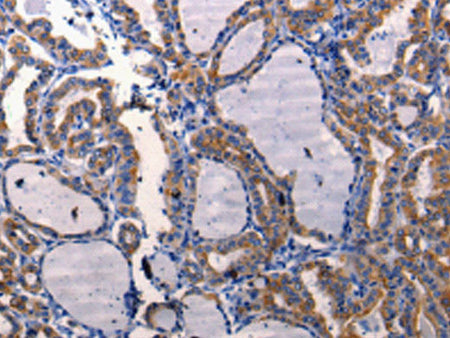 DRD1 Polyclonal Antibody Store at -20°C