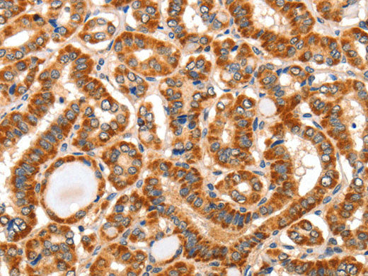 AIM2 Polyclonal Antibody Store at -20°C