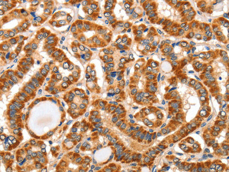 AIM2 Polyclonal Antibody Store at -20°C