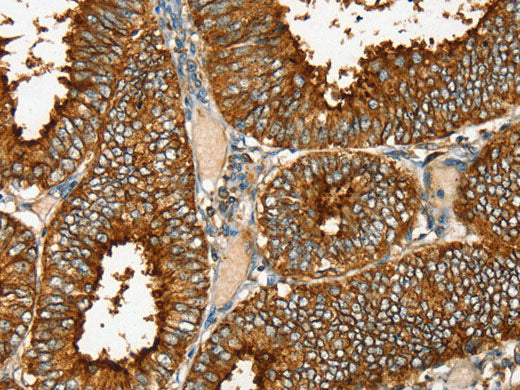 RAB25 Polyclonal Antibody Store at -20°C