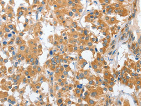 CHMP4B Polyclonal Antibody Store at -20°C