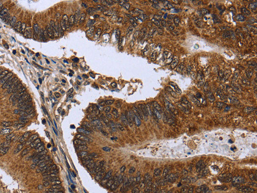 FGFR1OP Polyclonal Antibody Store at -20°C