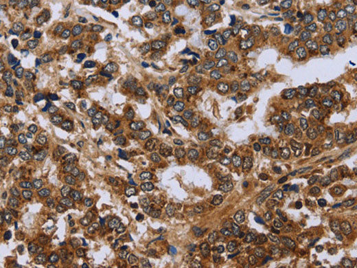 FH Polyclonal Antibody Store at -20°C