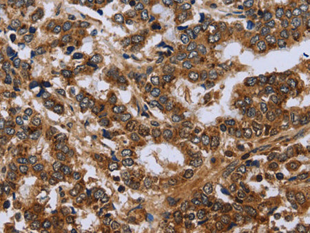 FH Polyclonal Antibody Store at -20°C