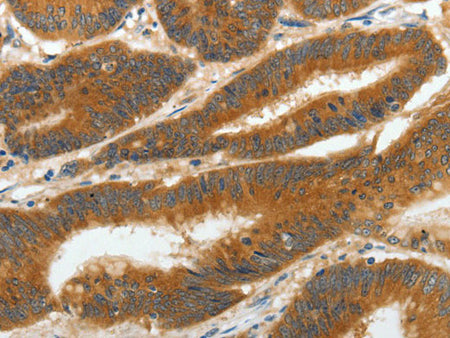 RGS2 Polyclonal Antibody Store at -20°C