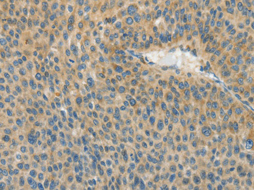 ASPA Polyclonal Antibody Store at -20°C
