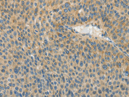 ASPA Polyclonal Antibody Store at -20°C