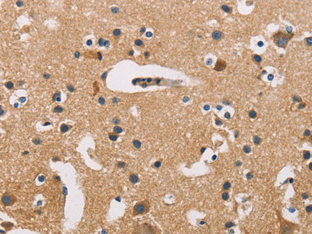ATP2C1 Polyclonal Antibody Store at -20°C