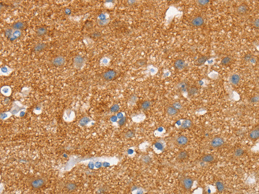 SNCA Polyclonal Antibody Store at -20°C