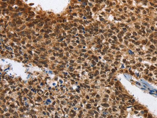 ELAVL1 Polyclonal Antibody Store at -20°C