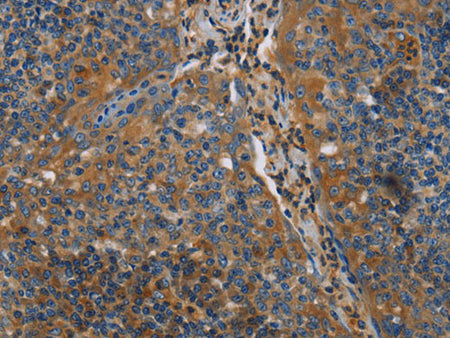 NRN1 Polyclonal Antibody Store at -20°C