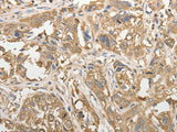 ADHFE1 Polyclonal Antibody Store at -20°C